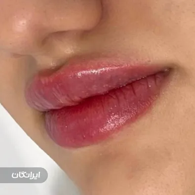 کلینیک زیبایی دکتر مریم بور