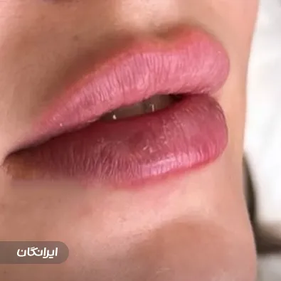 کلینیک زیبایی دکتر مریم بور