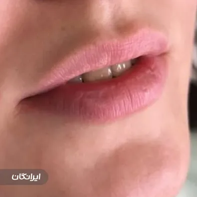 کلینیک زیبایی دکتر مریم بور