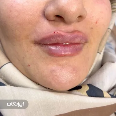 کلینیک زیبایی هرمس