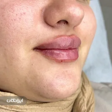 کلینیک زیبایی هرمس