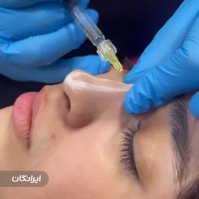 کلینیک زیبایی آلفا