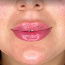 کلینیک زیبایی آذرخش