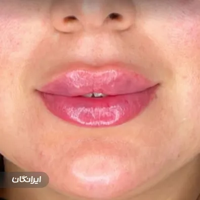 کلینیک زیبایی آذرخش