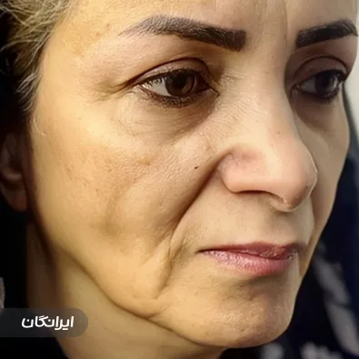 کلینیک زیبایی دکتر گیتی باب المراد