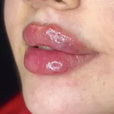 کلینیک زیبایی دکتر ابوالفضل محمودلو