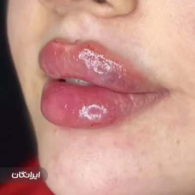 کلینیک زیبایی دکتر ابوالفضل محمودلو