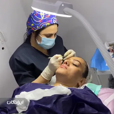 کارشناس کاشت مو سحر محمدی