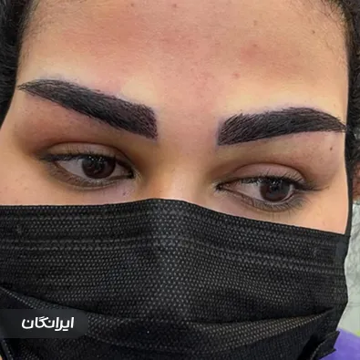 کارشناس کاشت مو سحر محمدی