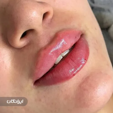 کلینیک زیبایی دکتر احمد دی زنگیان مفرد