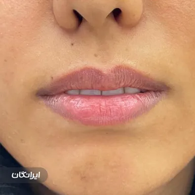 کلینیک زیبایی دکتر احمد دی زنگیان مفرد