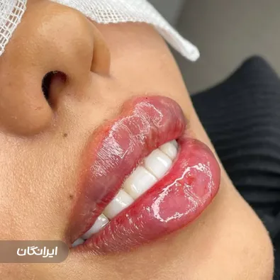 کلینیک زیبایی دکتر احمد دی زنگیان مفرد