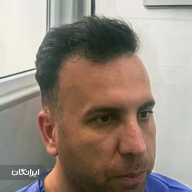 کلینیک کاشت مو ترلان رزم