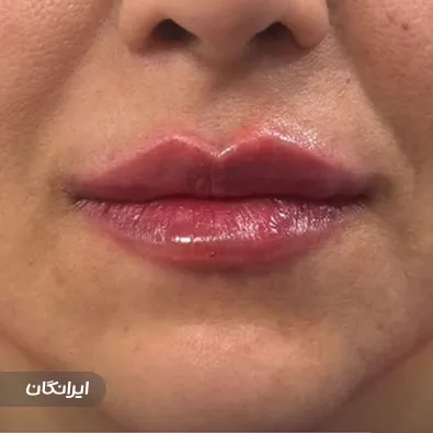 کلینیک زیبایی دکتر ندا کرم پور