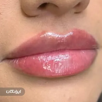 کلینیک زیبایی هلسا