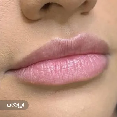 کلینیک زیبایی هلسا