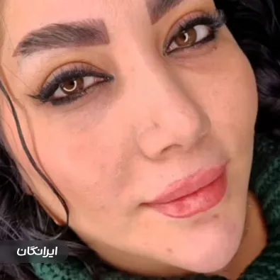 کلینیک زیبایی نیلای