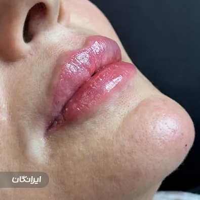 کلینیک زیبایی میرال بیوتی