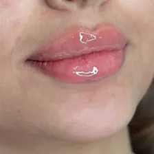 کلینیک زیبایی میرال بیوتی