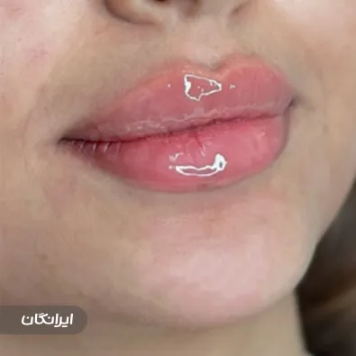 کلینیک زیبایی میرال بیوتی