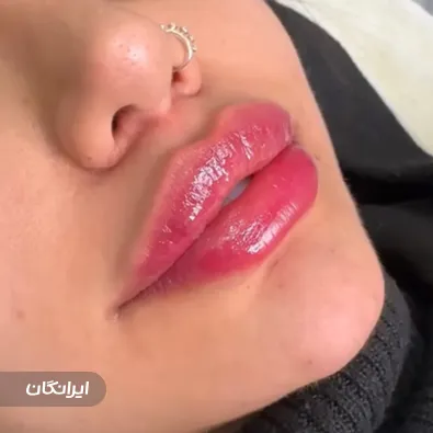 کلینیک زیبایی گلد