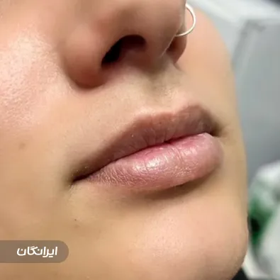 کلینیک زیبایی گلد