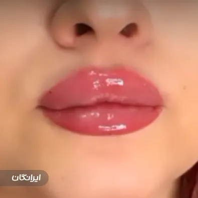 کلینیک زیبایی گلد