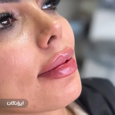 کلینیک زیبایی آرزو