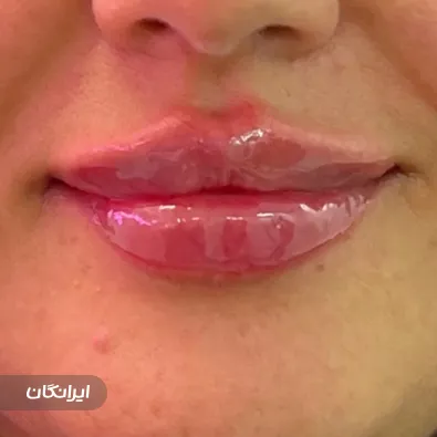 کلینیک زیبایی نیولایف