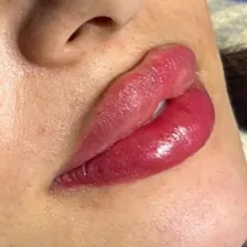 کلینیک زیبایی نیولایف