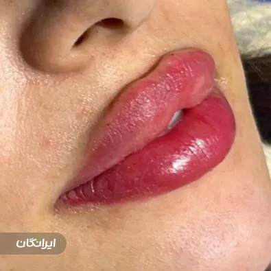 کلینیک زیبایی نیولایف