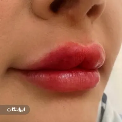 کلینیک زیبایی درمیس