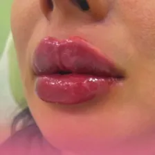 کلینیک زیبایی درمیس