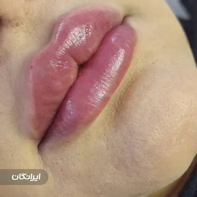 کلینیک زیبایی درمیس