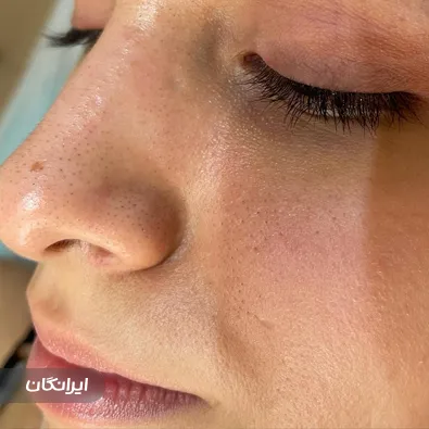 کلینیک زیبایی بهسیما