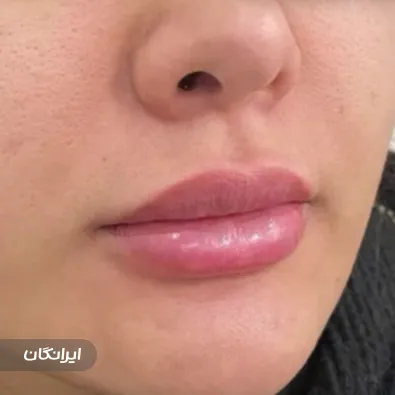 کلینیک زیبایی پریفام