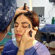 مرکز کاشت مو دنیز