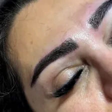 کارشناس کاشت مو بهار حسینی