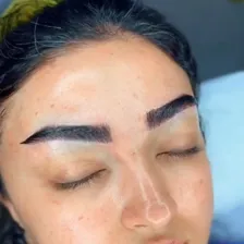 کارشناس کاشت مو شیما اوجی