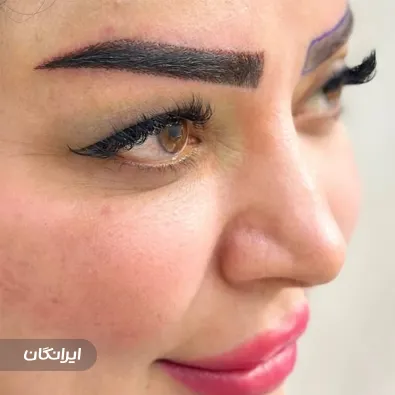 کلینیک زیبایی دایموند