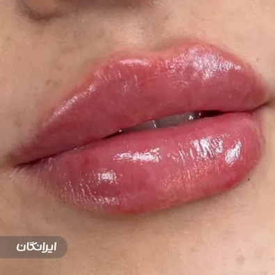 کلینیک زیبایی پرنسا