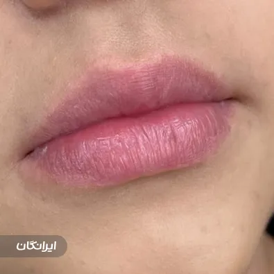 کلینیک زیبایی پرنسا