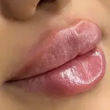 کلینیک زیبایی پرنسا