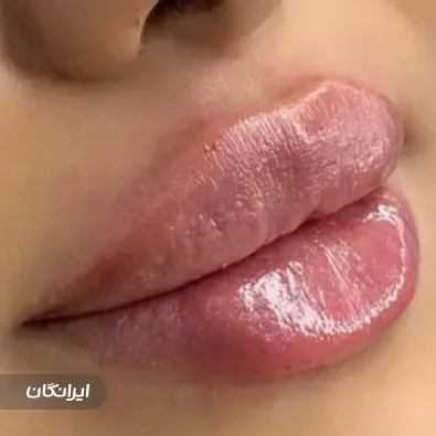 کلینیک زیبایی پرنسا