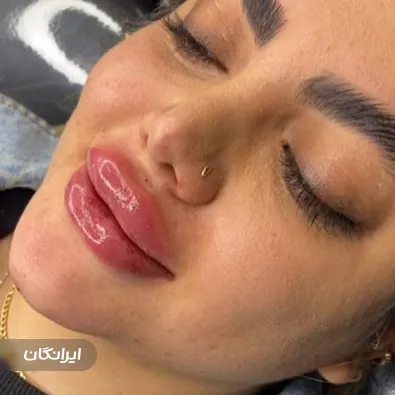 کلینیک زیبایی آوا