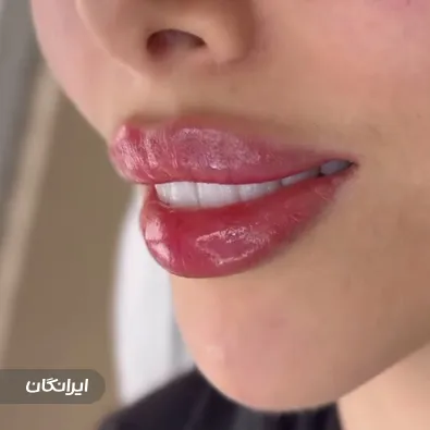 کلینیک زیبایی رز