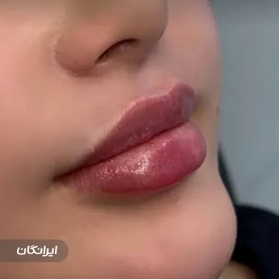 کلینیک زیبایی ماه چهره