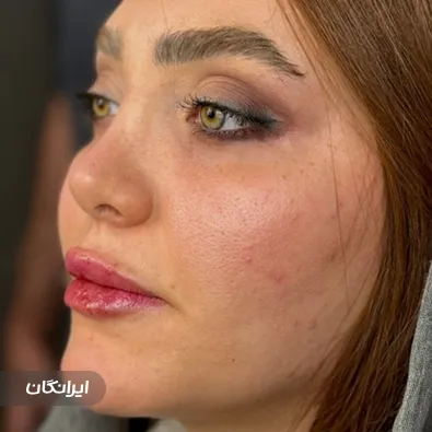 کلینیک زیبایی ماه چهره