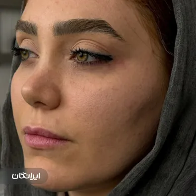 کلینیک زیبایی ماه چهره