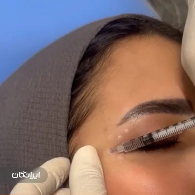 کلینیک زیبایی میرا